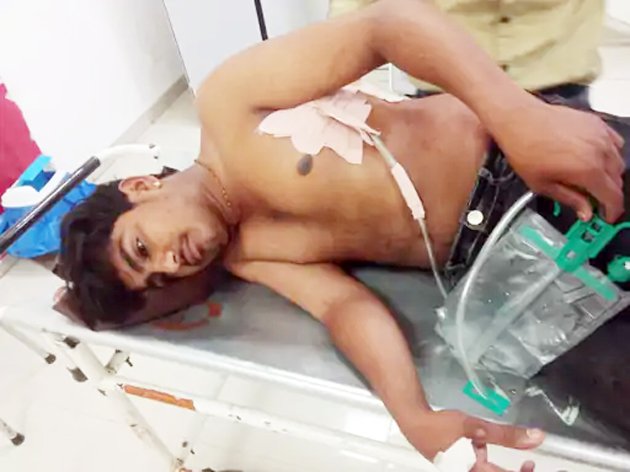 बाइक टकराने पर हुआ विवाद : पीछा कर दूध व्यवसायी को मारा चाकू, 4 टांके आए