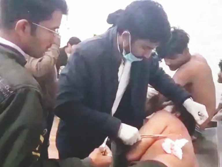 चौकीदार समेत तीन बेटों पर चाकू से हमला : ठेकेदार को पीटने से बचाने गए थे, अवैध नल कनेक्शन पर हुआ विवाद