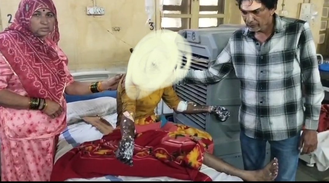 ई-स्कूटी में भीषण धमाका: मां और दो बच्चे गंभीर रूप से झुलसे, घर का सामान खाक
