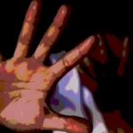 रतलाम में शर्मसार करने वाली घटना: दिव्यांग मानसिक विक्षिप्त महिला से दुष्कर्म, 5 माह की गर्भवती; पुलिस जांच में जुटी